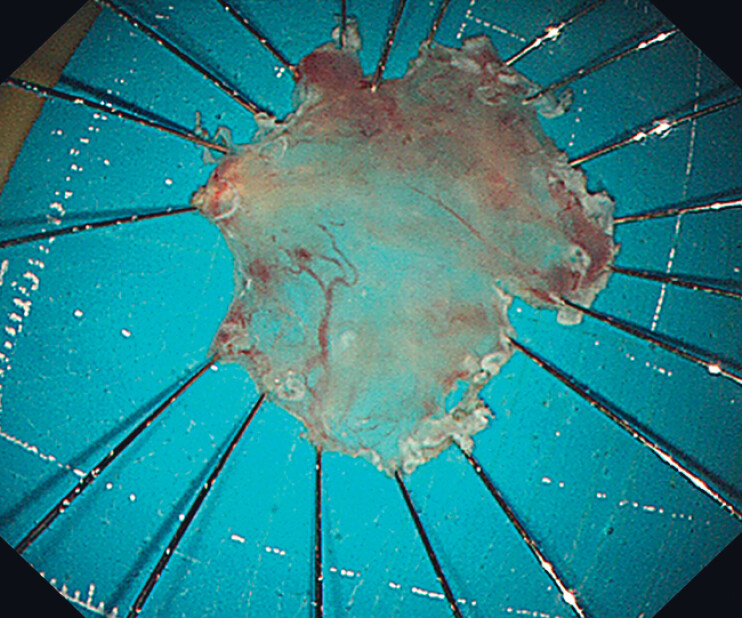 Fig. 3