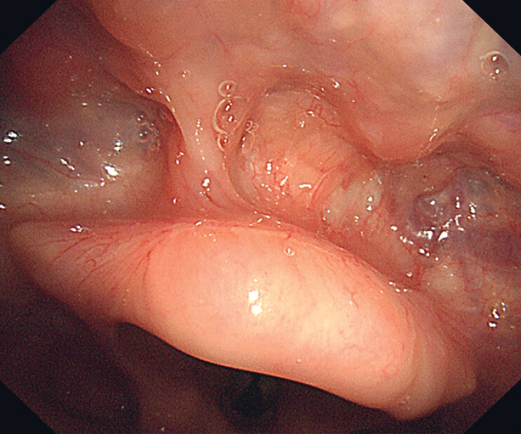 Fig. 5