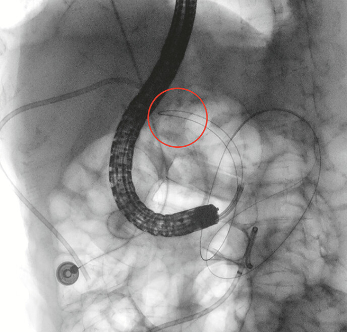 Fig. 3