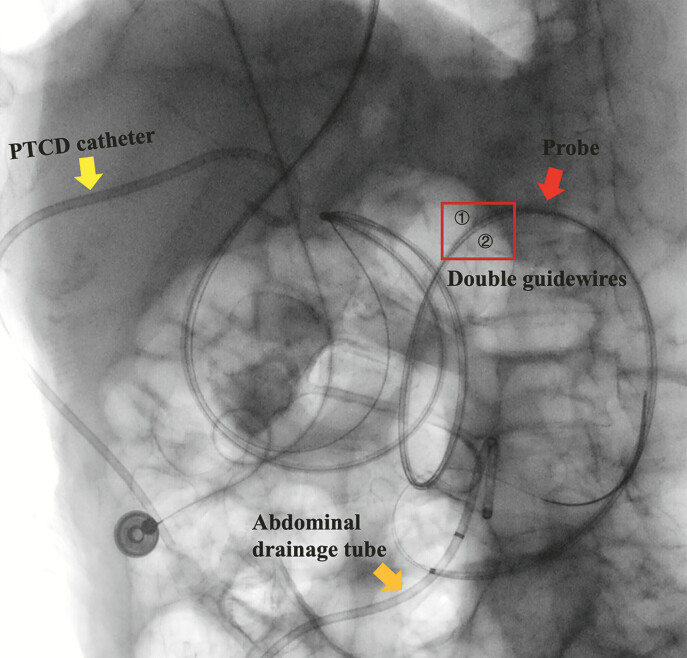Fig. 4