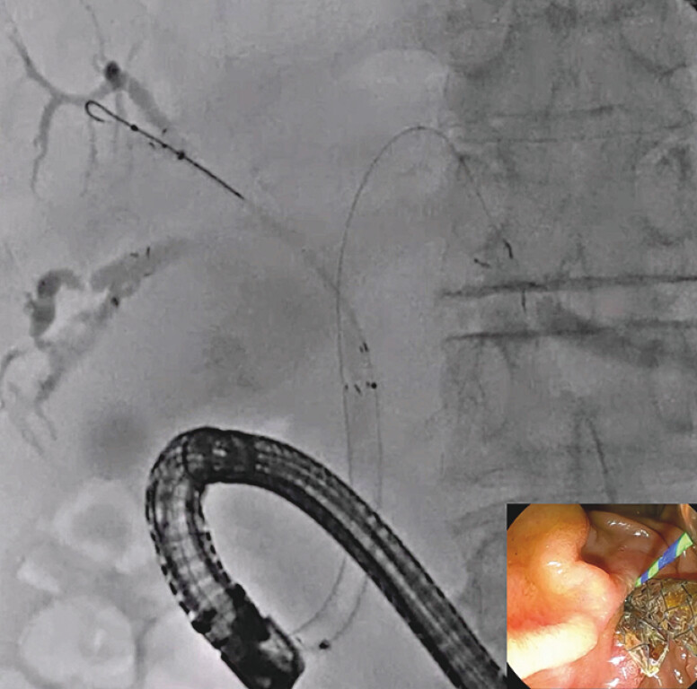 Fig. 4