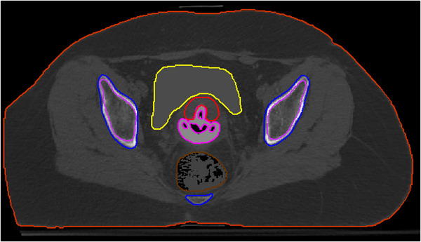 FIGURE 2