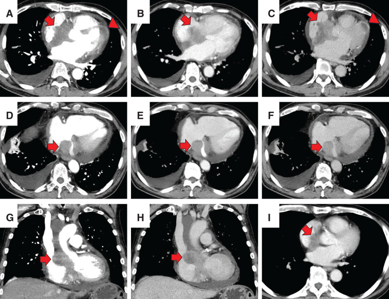 Fig. 8