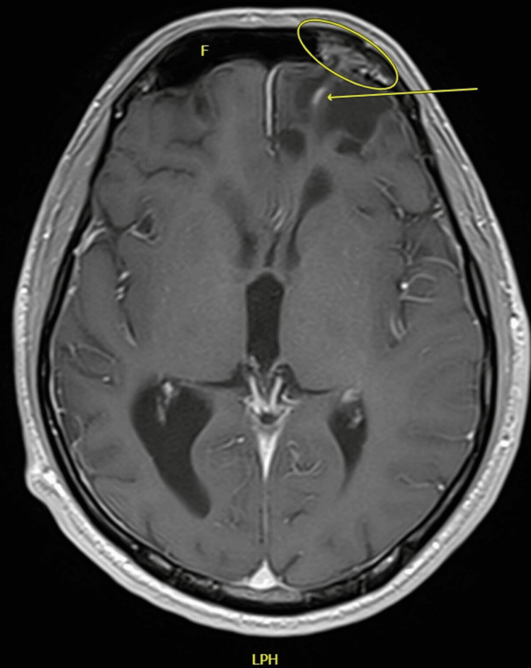 Figure 5
