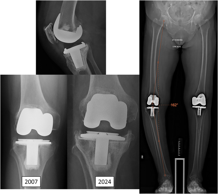 FIGURE 5