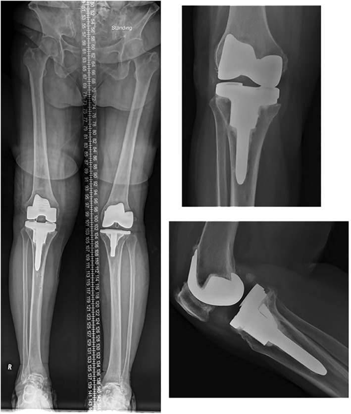 FIGURE 4