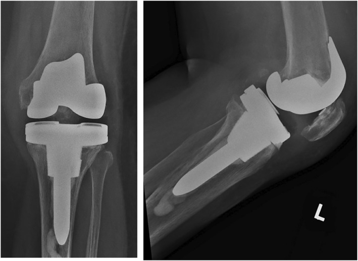 FIGURE 9
