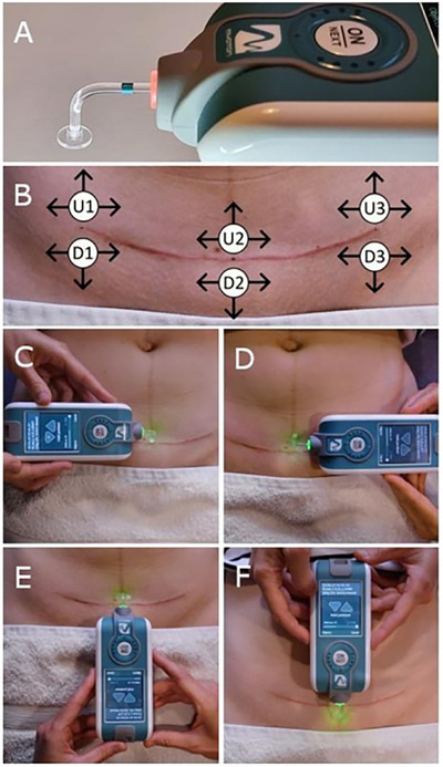 FIGURE 1