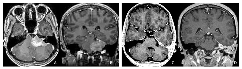 Figure 12