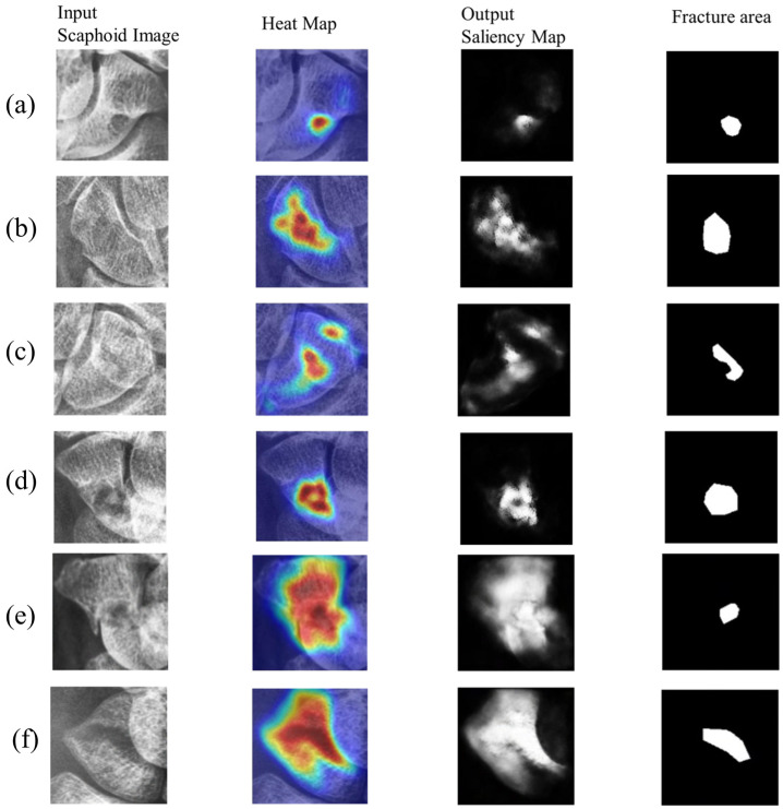 Figure 12