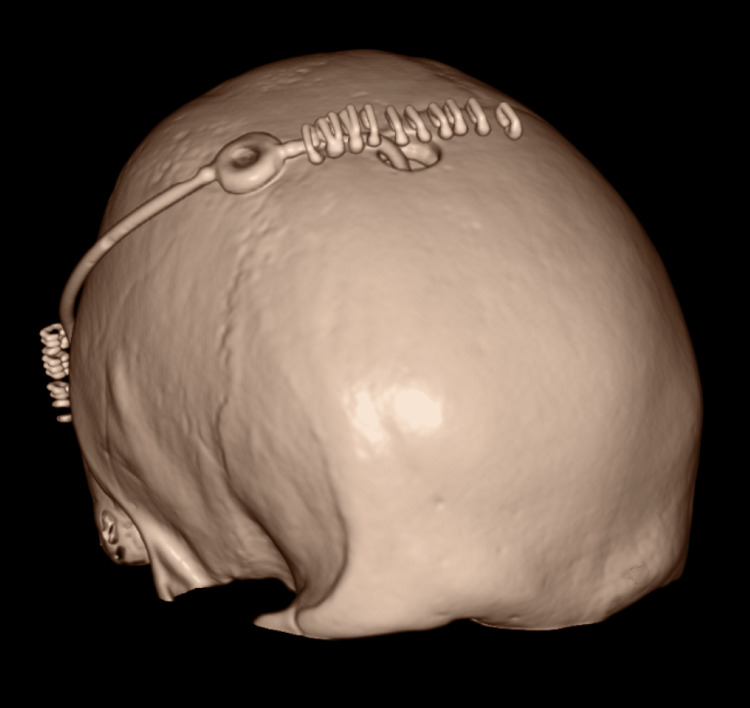 Figure 9