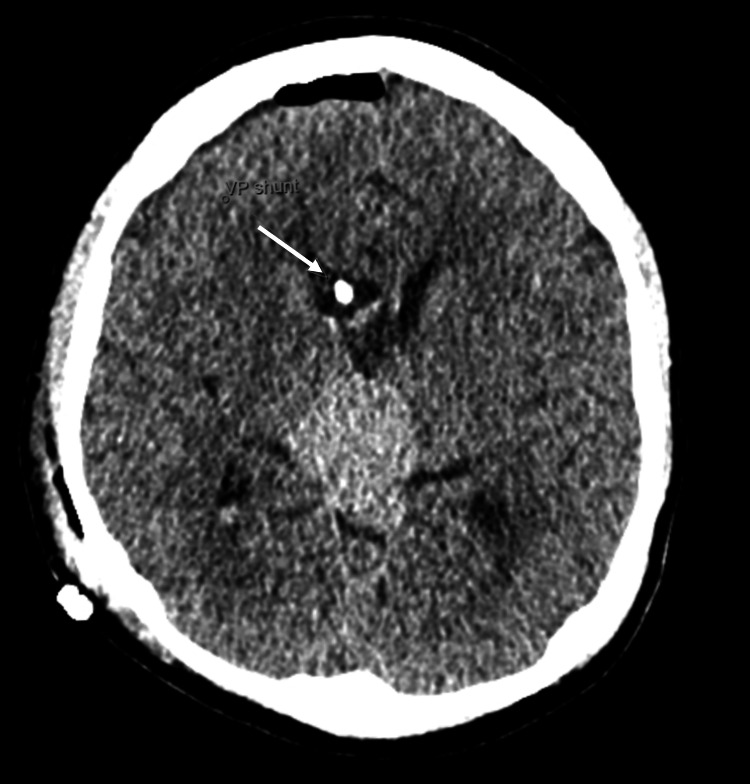 Figure 11