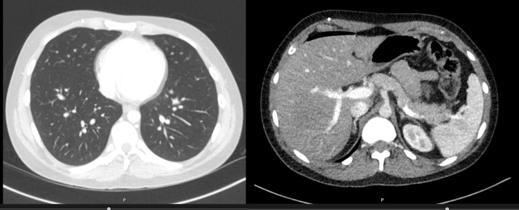 Figure 12