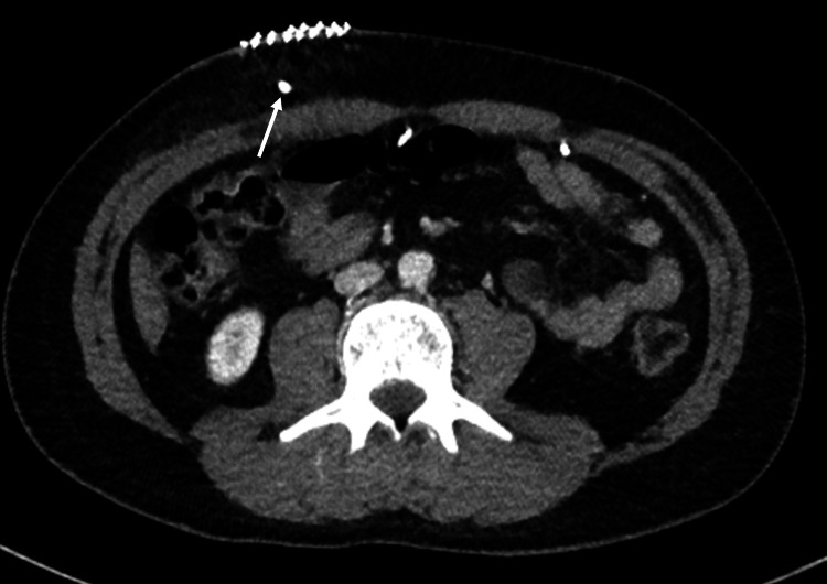 Figure 13