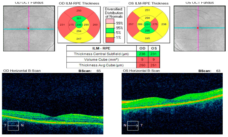 Figure 12