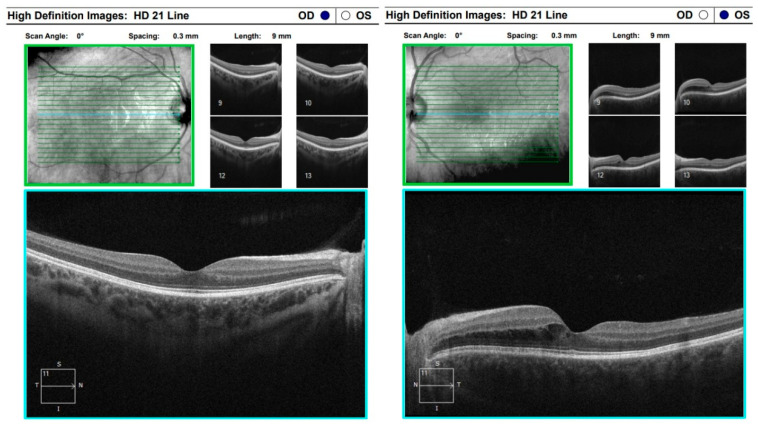 Figure 13