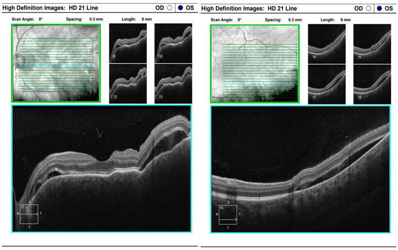 Figure 16