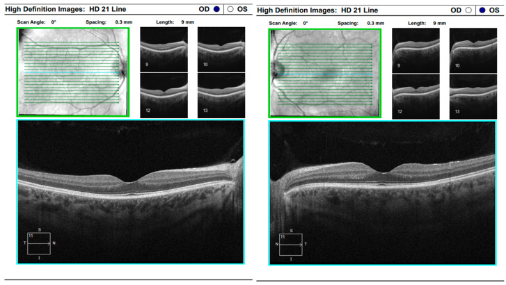 Figure 17