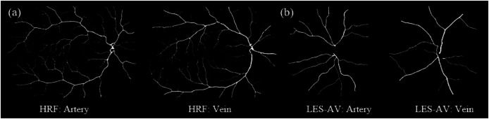 Figure 14
