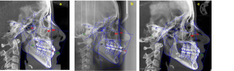 Figure 12