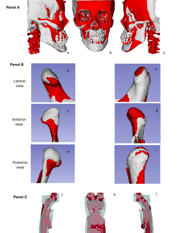 Figure 13