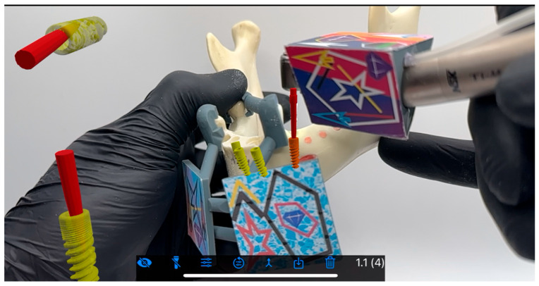 Figure 4