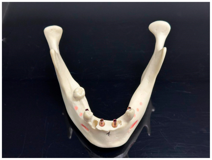 Figure 9