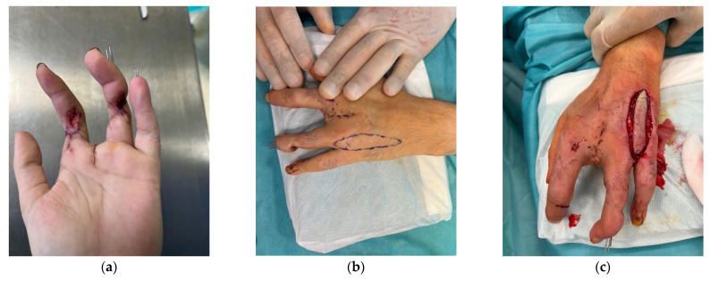 Figure 5