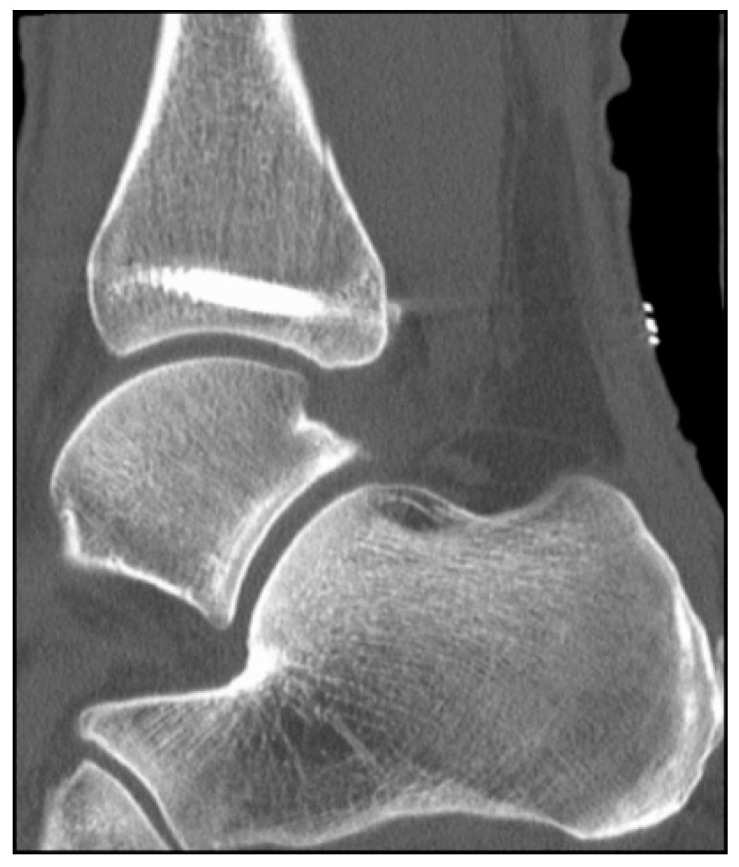 Figure 10