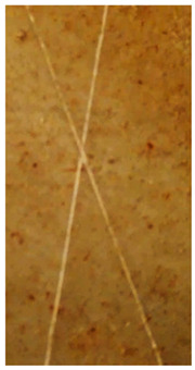 Figure 25
