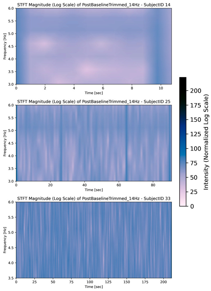 Figure 11