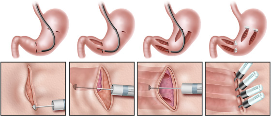 FIGURE 1