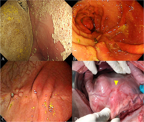 FIGURE 3