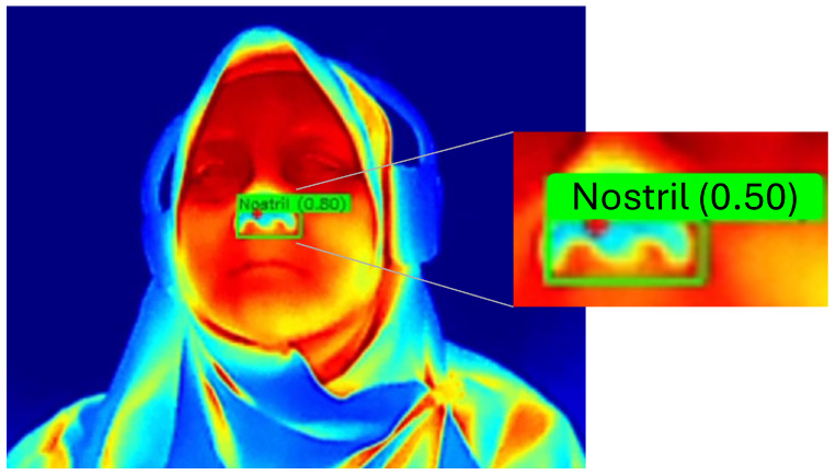 Figure 12
