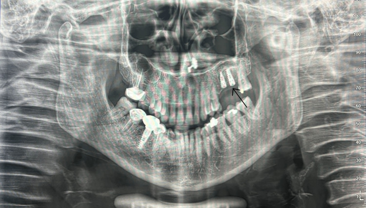 Figure 7