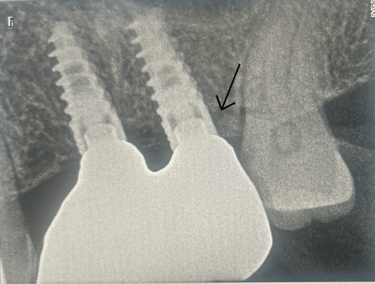 Figure 9