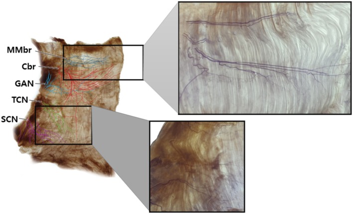 FIGURE 2