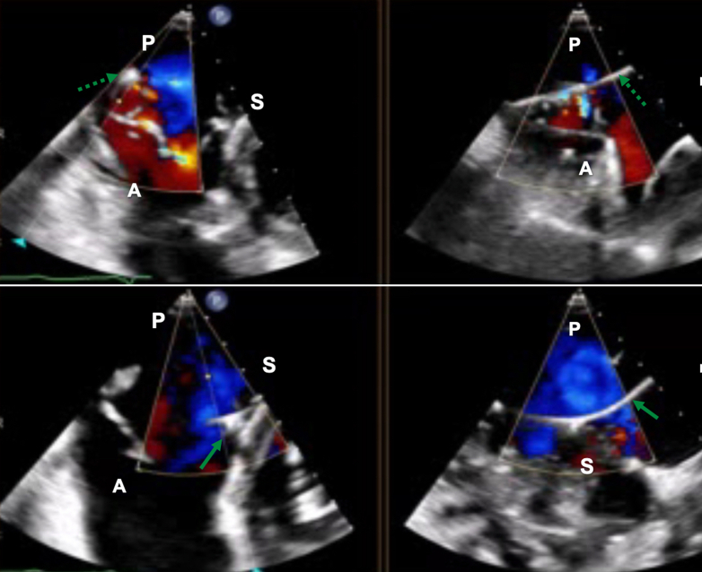 Figure 5