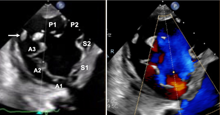 Figure 6
