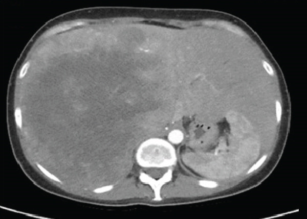 Figure 12