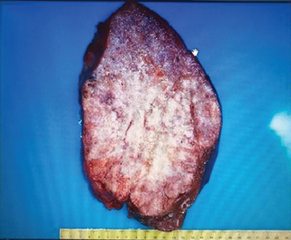Figure 14