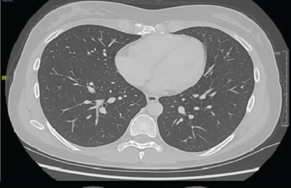Figure 15