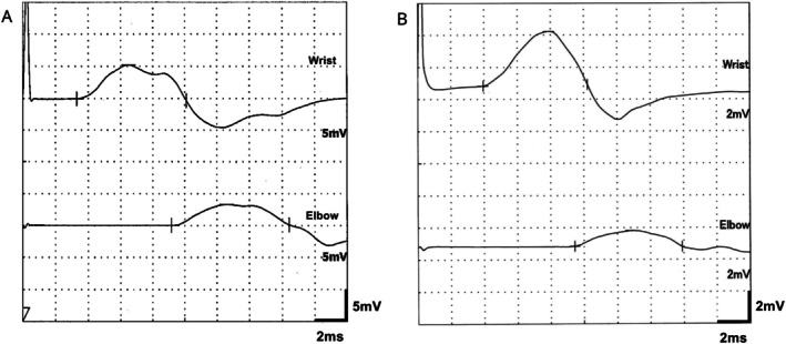 FIGURE 3