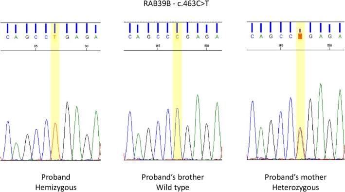 FIGURE 3