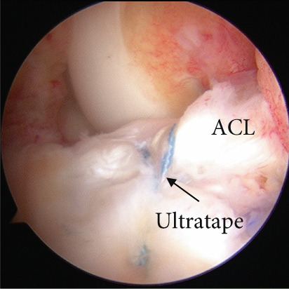 Figure 9
