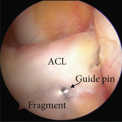 Figure 11