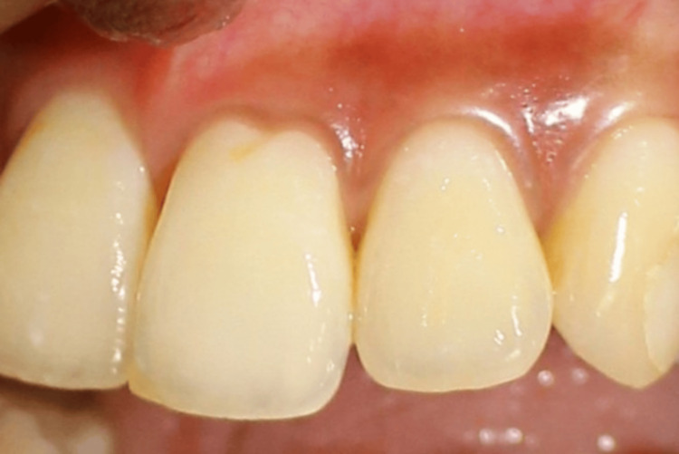 Figure 13