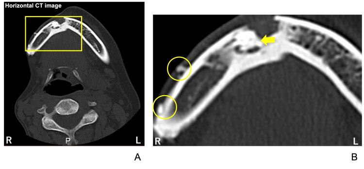 Figure 6