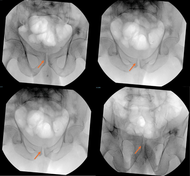 Figure 7