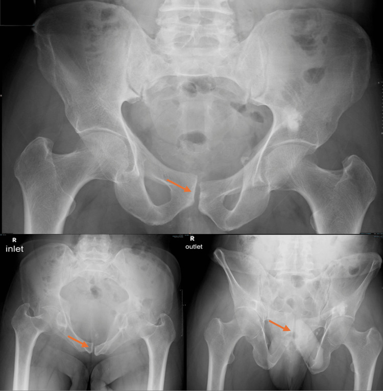 Figure 12